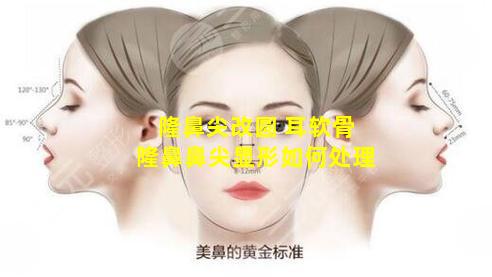 隆鼻尖改圆 耳软骨隆鼻鼻尖显形如何处理